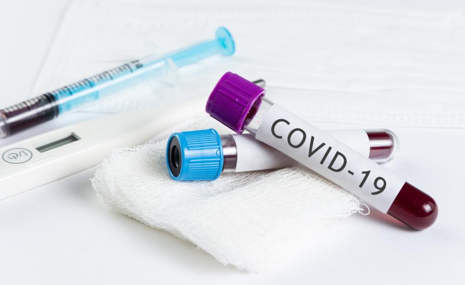 На Кубани за сутки выявили 239 случаев заболевания COVID-19 